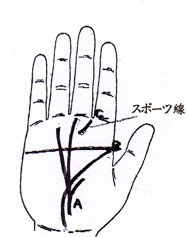 A.副生命線から太陽線がくっきり立ち上がっていて、自分の肉体的エネルギーを通して有名になる人。B.感情線と頭脳線が一本につながったマスカケ線のある人は、興味のあることには徹底的に取り組み、極められる力を持っているので、スポーツ選手として大成します。C.スポーツ線と副生命線がある。ずば抜けた体力や行動力を持ち運動神経が発達しています。（注）◆ スポーツ線 運動神経の発達◆ 副生命線 スタミナがあり病気してもすぐ回復する